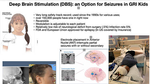 Deep Brain Stimulation Poster